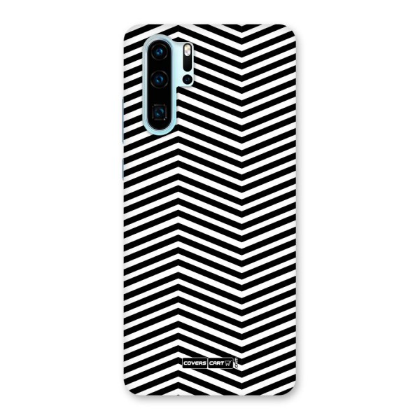 Classy Zig Zag Back Case for Huawei P30 Pro