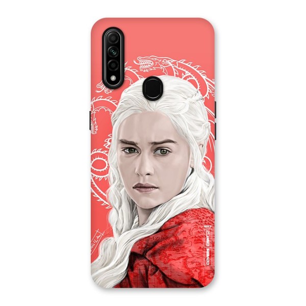 Khaleesi The Living Dragon Back Case for Oppo A31