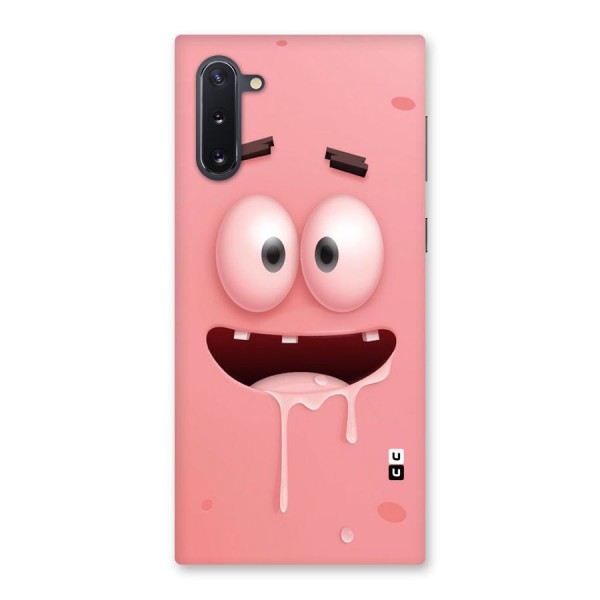 Watery Mouth Back Case for Galaxy Note 10