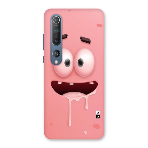 Watery Mouth Back Case for Mi 10