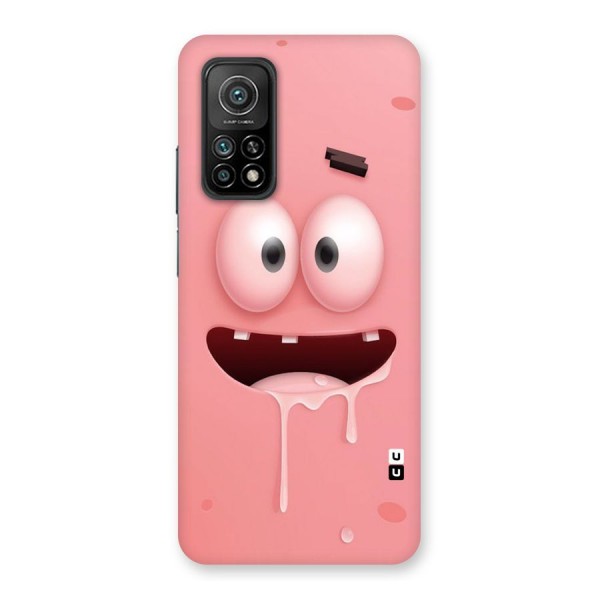 Watery Mouth Back Case for Mi 10T Pro 5G