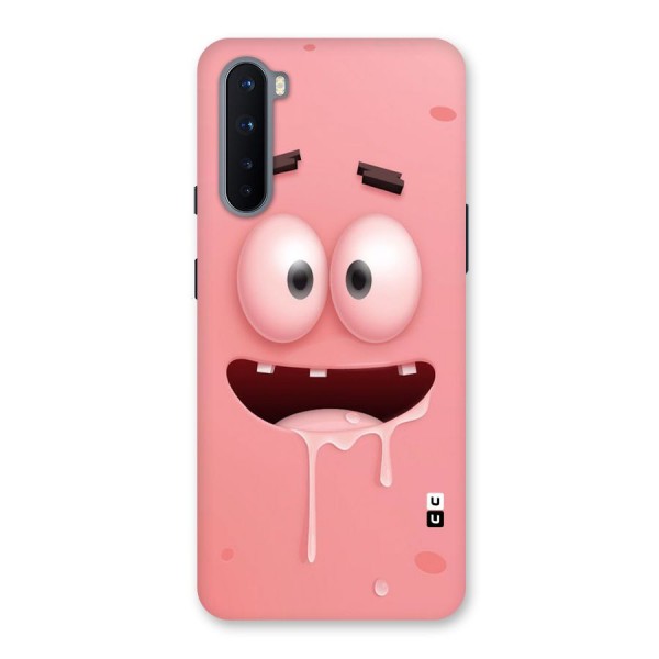 Watery Mouth Back Case for OnePlus Nord