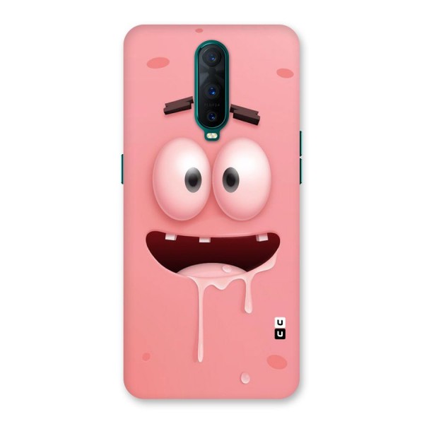 Watery Mouth Back Case for Oppo R17 Pro