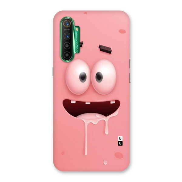 Watery Mouth Back Case for Realme X2