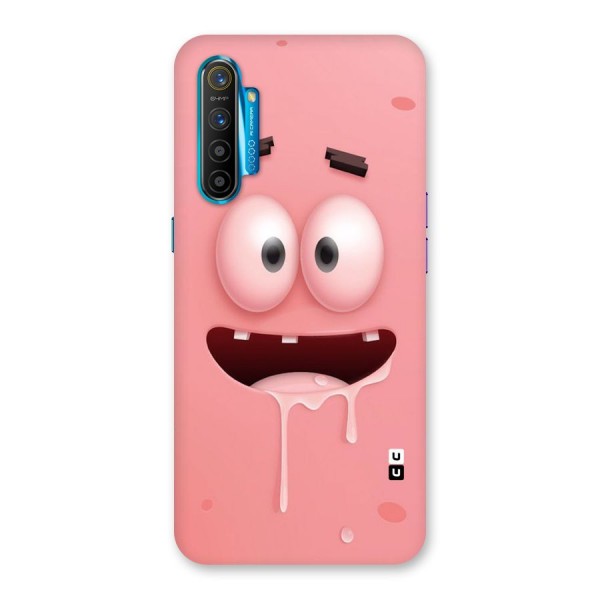 Watery Mouth Back Case for Realme XT