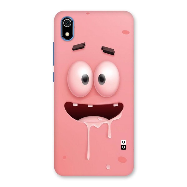 Watery Mouth Back Case for Redmi 7A