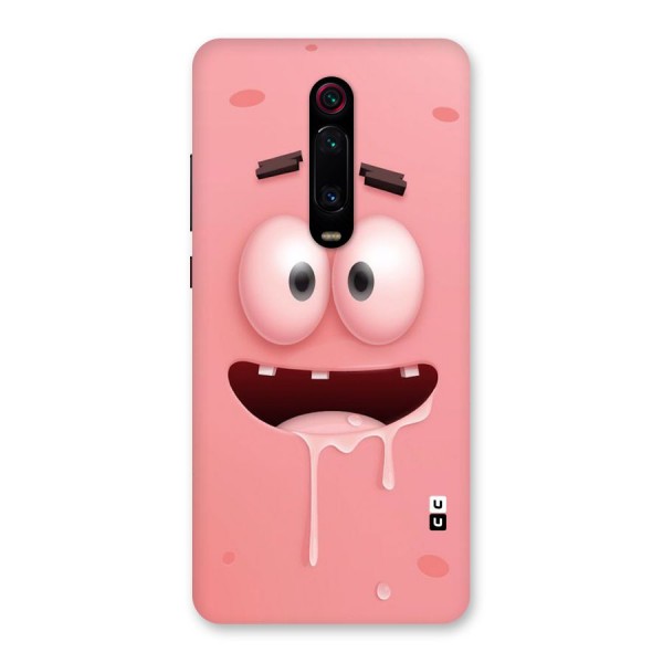 Watery Mouth Back Case for Redmi K20 Pro