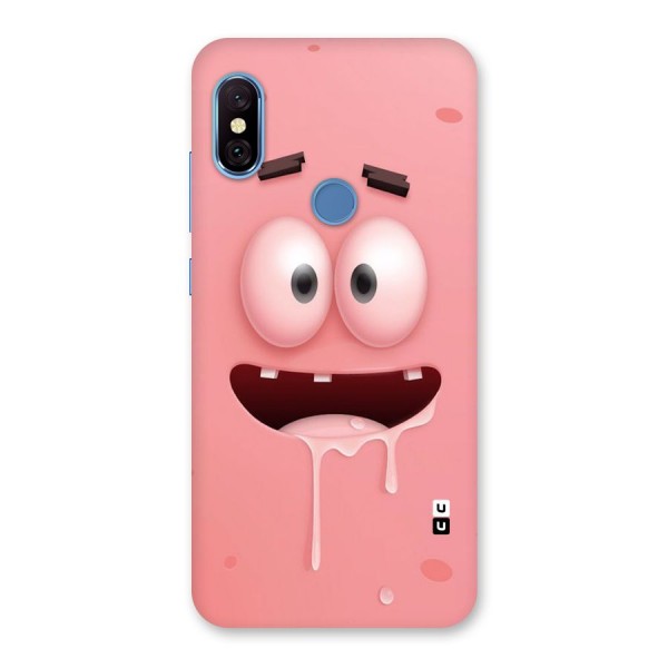 Watery Mouth Back Case for Redmi Note 6 Pro