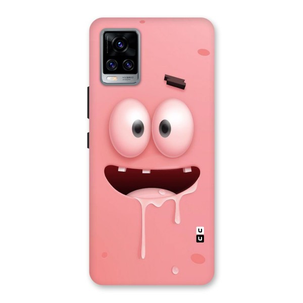 Watery Mouth Back Case for Vivo V20 Pro