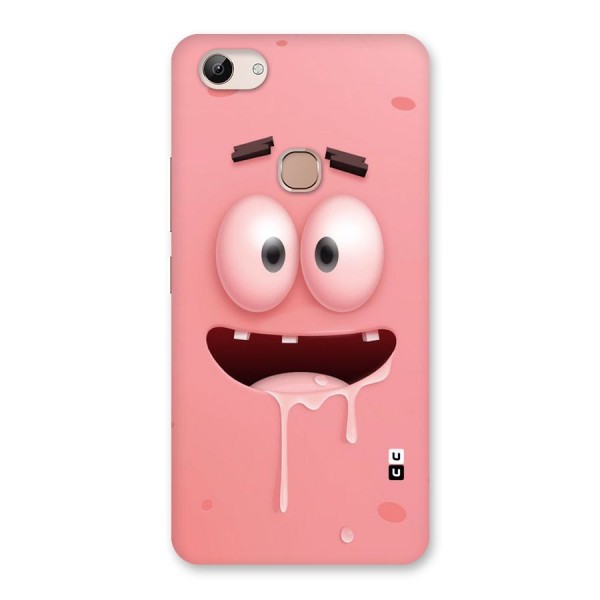 Watery Mouth Back Case for Vivo Y83