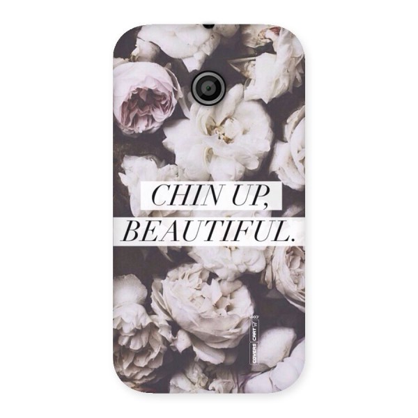 Chin Up Beautiful Back Case for Moto E