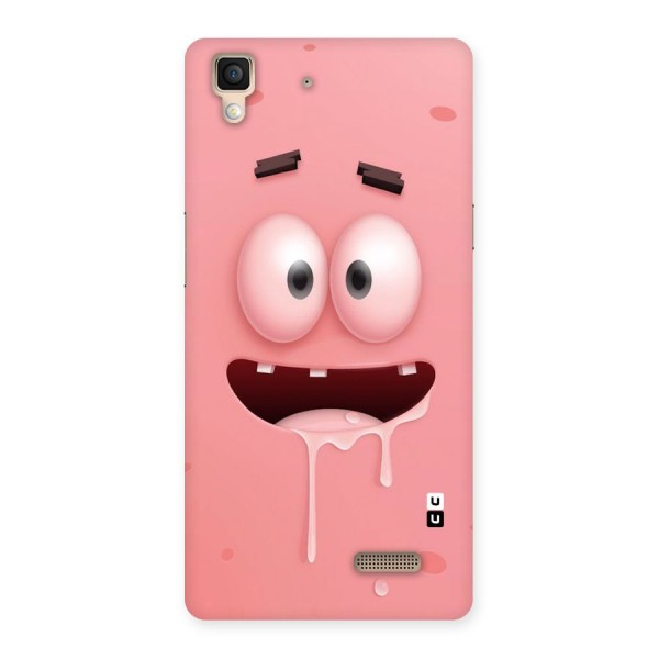 Watery Mouth Back Case for Oppo R7