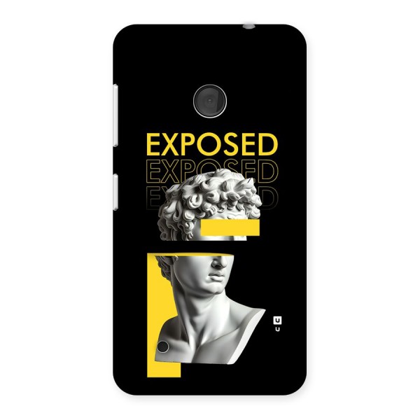 Exposed Sculpture Back Case for Lumia 530