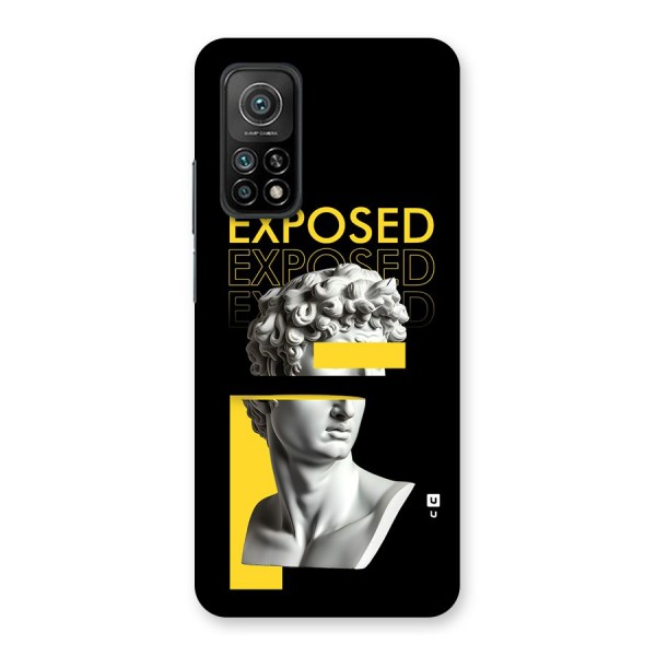 Exposed Sculpture Back Case for Mi 10T 5G