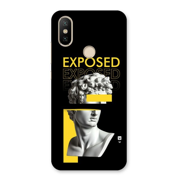 Exposed Sculpture Back Case for Mi A2