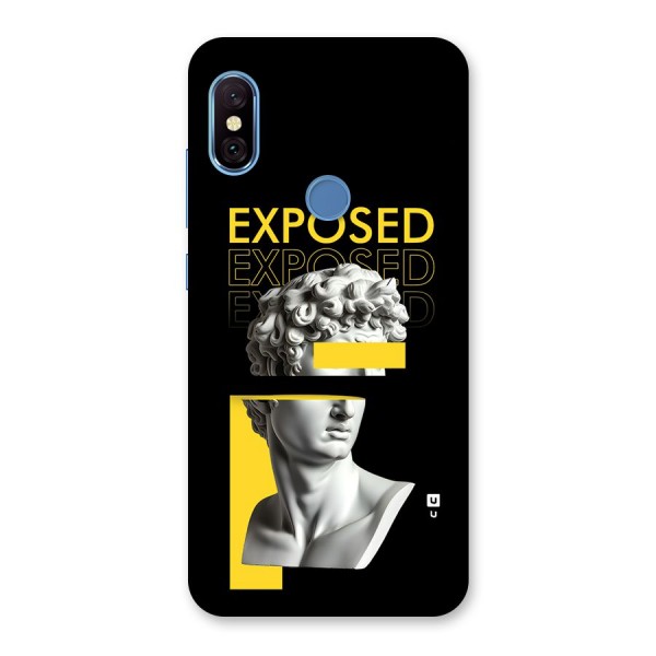 Exposed Sculpture Back Case for Redmi Note 6 Pro