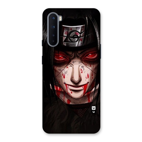 Itachi Uchiha Red Eyes Back Case for OnePlus Nord