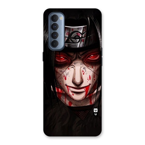 Itachi Uchiha Red Eyes Back Case for Reno4 Pro