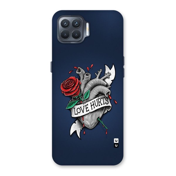 Love Hurts Back Case for Oppo F17 Pro