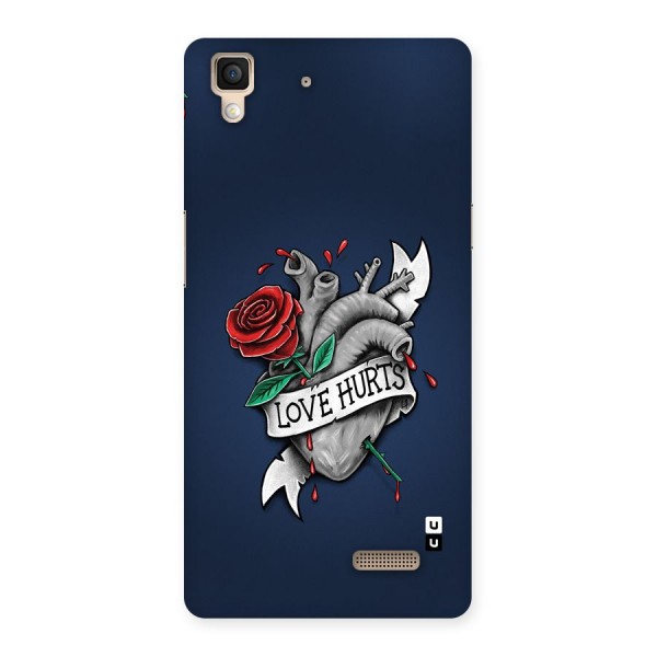 Love Hurts Back Case for Oppo R7