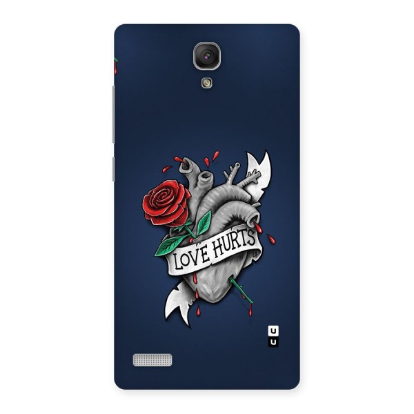 Love Hurts Back Case for Redmi Note Prime