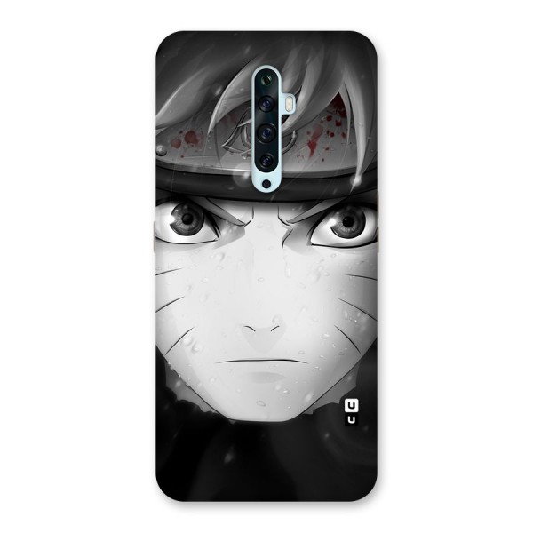 Naruto Monochrome Back Case for Oppo Reno2 Z