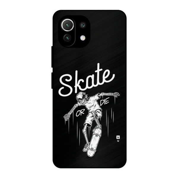 Skate Or Die Metal Back Case for Mi 11 Lite